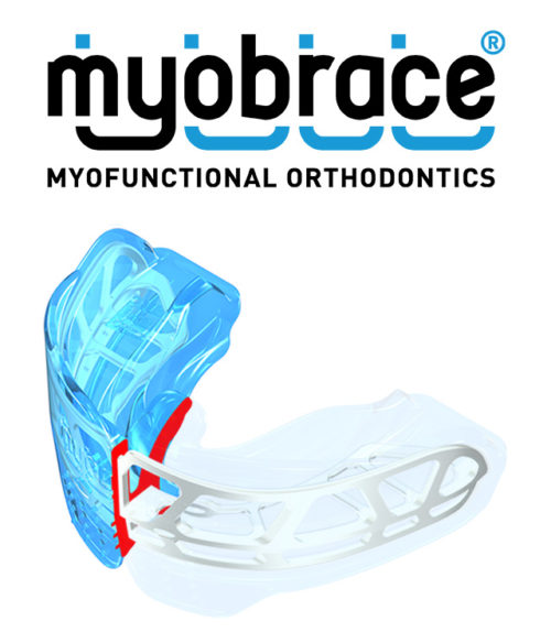 Myobrace