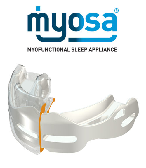 myOSA