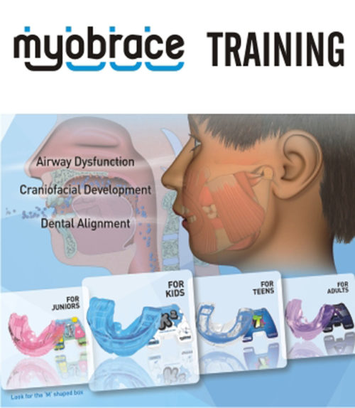 Inhouse Myobrace Training