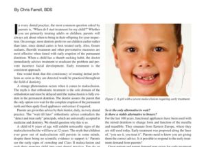 The Common Myths of Orthodontic Treatment